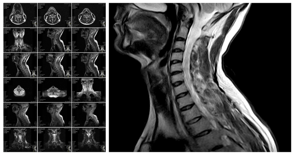 なかがわ整形の新型ＭＲＩ