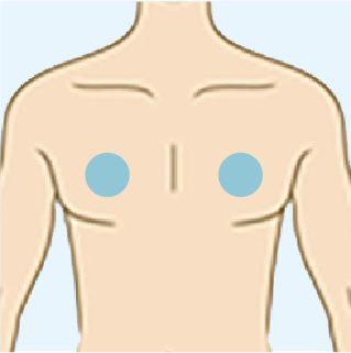 男性乳輪