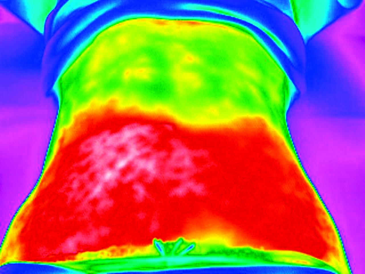 熱分布（腹部）