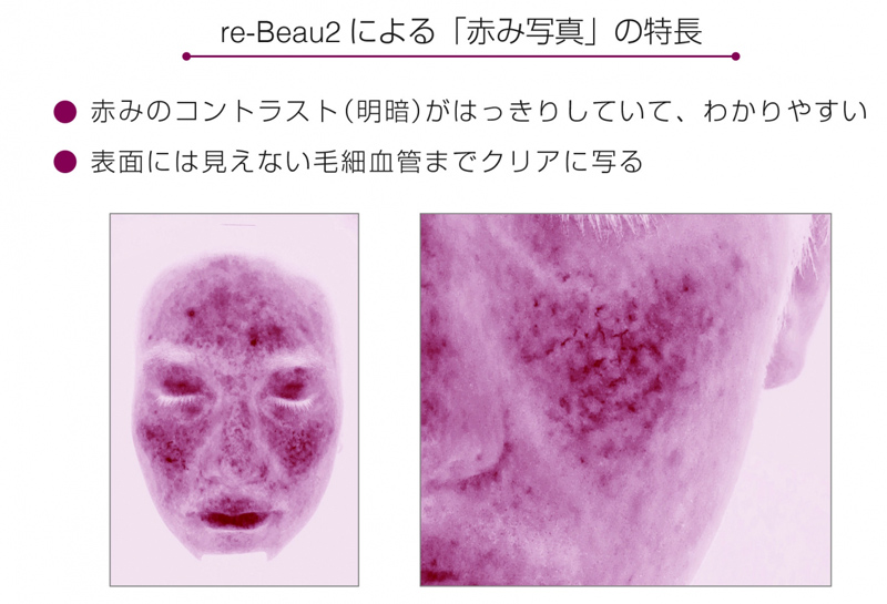 re-Beau 2による「赤み写真」の特徴