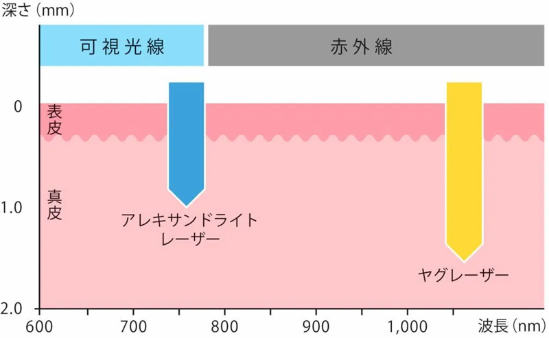 レーザー光の皮膚への深達度を表す図