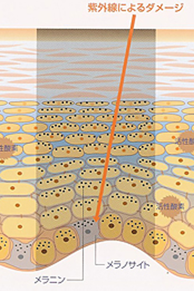 紫外線によるメラニンの生成を表す図